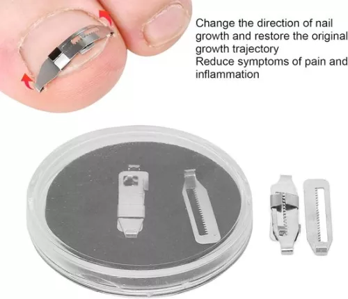 merkloos Ingrown Toenail Corrector 2PCS Stainless Steel Paronychia Correction Tool (8785306004007)