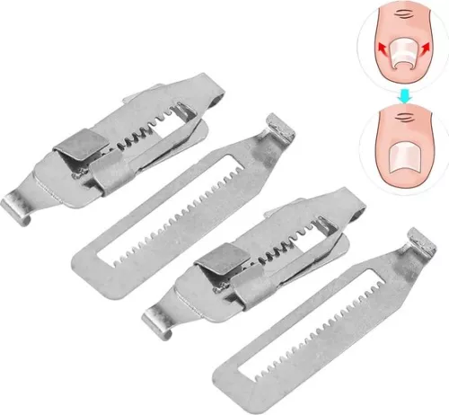 merkloos Ingrown Toenail Corrector 2PCS Stainless Steel Paronychia Correction Tool (8785306004007)