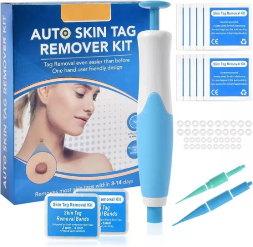 Skin tag removal kit - Fast acting and safe skin tag remover for small skin tags 2-8mm