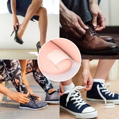 merkloos 40 pieces of ingrown toenail smoothing strips with toenail lifter for correction of ingrown toenails (9509465873675)