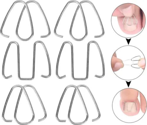 merkloos Ingrown Toenail Corrector Hook - Nail Correction Strips Thread Lifter Tool for Recovery - Women Men Corrector . (8785309165095)