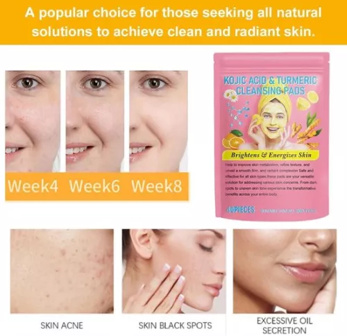 merkloos 40 pieces Turmeric Kojic Acid Cleansing Pads with Turmeric - Compressed Turmeric Kojic Acid Pads - Dark spot remover - Korean Skincare (6151903472433)