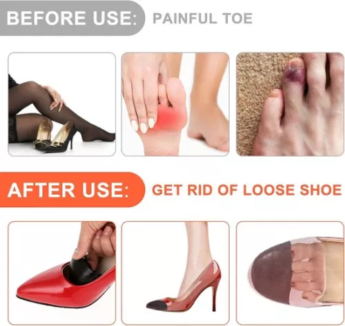 merkloos 3 Pairs of Toe Fillers - Inserts for Oversized Shoes - Adjustable Shoe Pads (8785322927007)