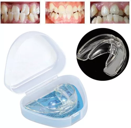 merkloos Night Braces for Straight Teeth - Comfortable Braces Design for Correction - Improve Teeth Position During Night - Easy to Use (8721085233245)